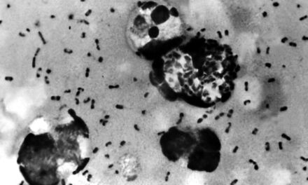Peste bubônica alterou o sistema imunológico humano, diz estudo