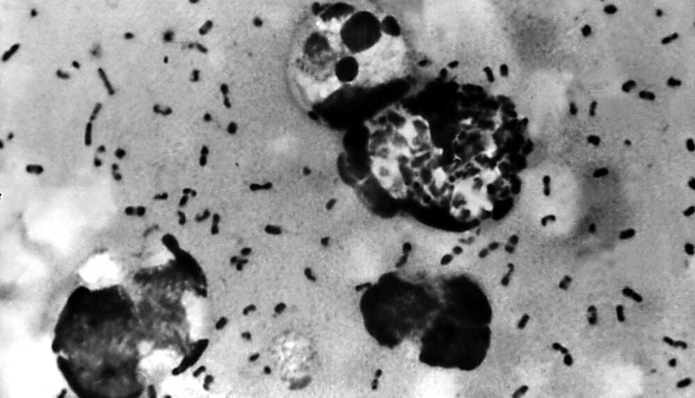 Peste bubônica alterou o sistema imunológico humano, diz estudo