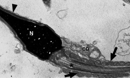 Covid-19 pode deixar rastro viral em espermatozoides por meses