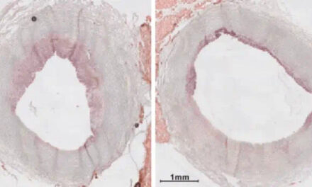 Terapia com nanopartículas pode combater problemas cardíacos